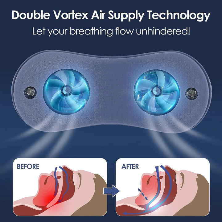 Micro CPAP-sömnapnémaskin för resor &amp; anti-snarkning – CPAP-alternativ