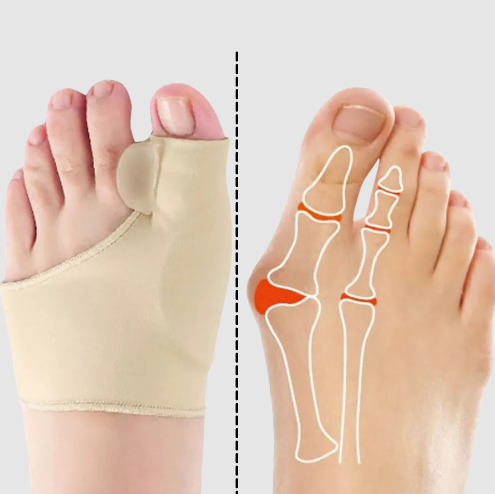 Gel-bunion korrigerare