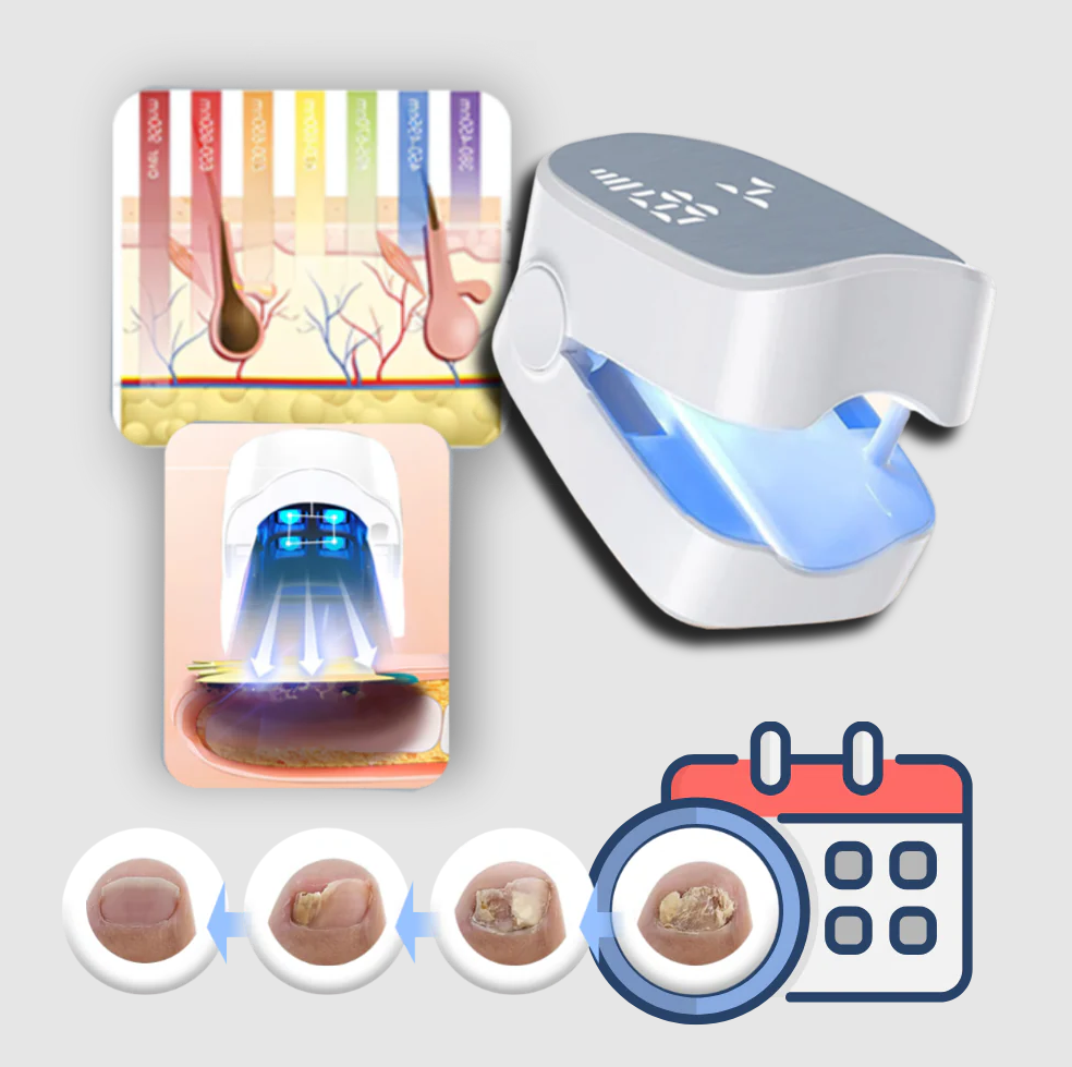 Smärtfri Nagelsvamp Laser