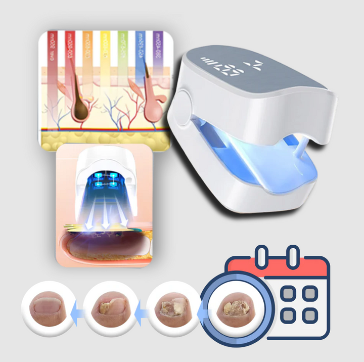 Smärtfri Nagelsvamp Laser