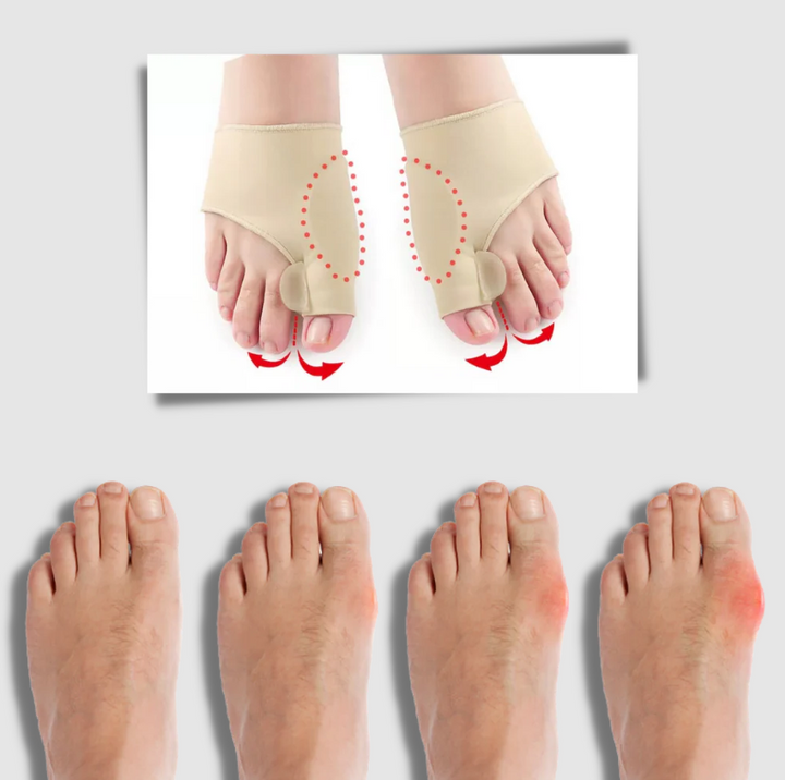 Gel-bunion korrigerare