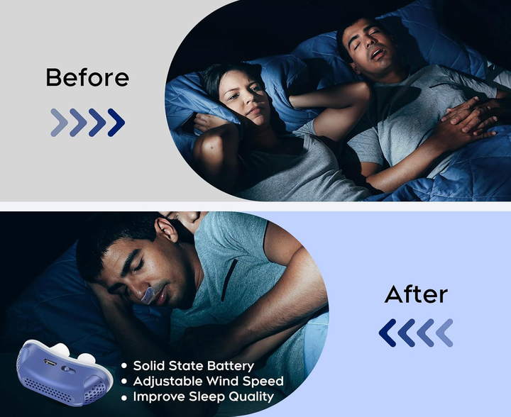 Mikro CPAP Sömnapné Maskin För Resor &amp; Anti-Snarkning - CPAP Alternativ