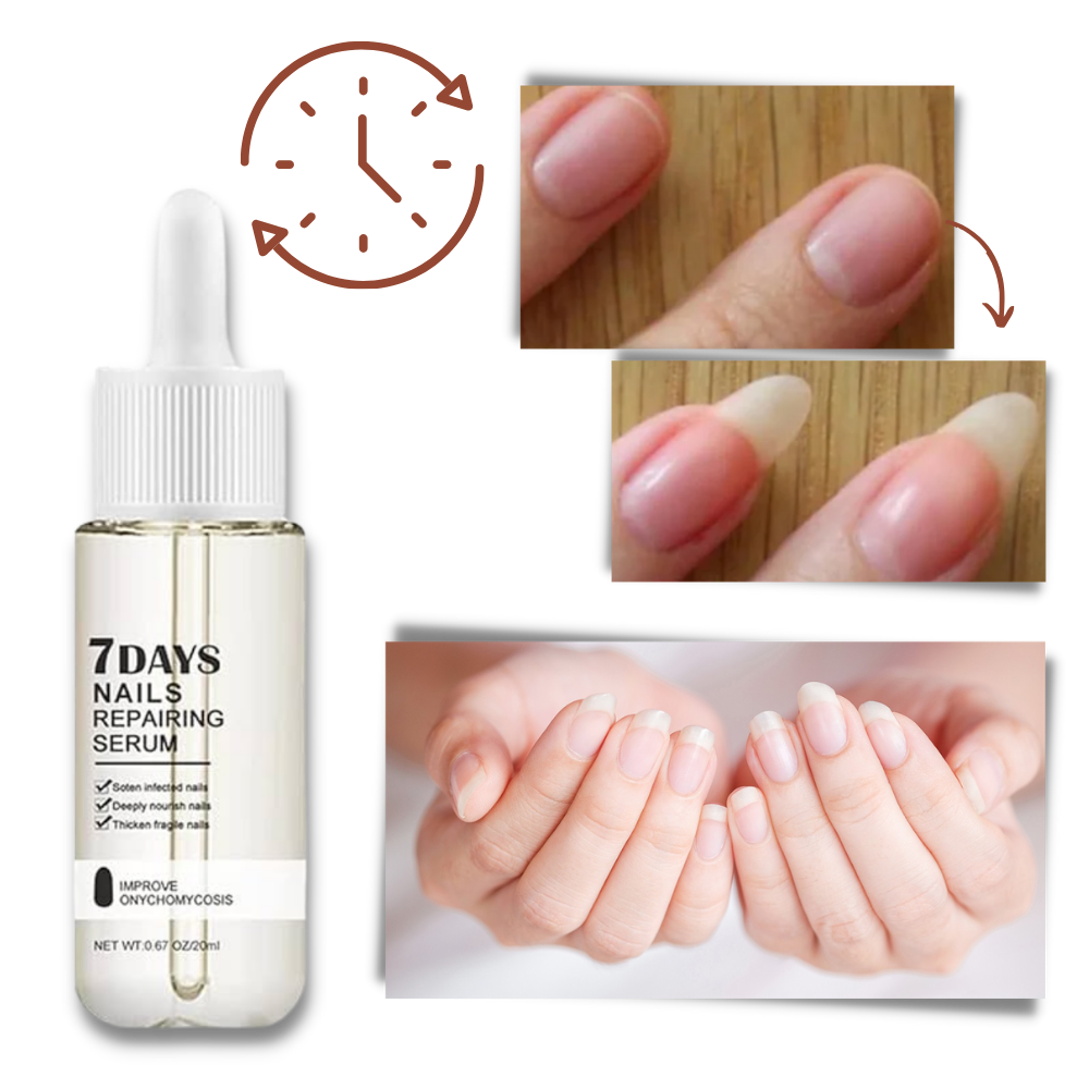 7 Dagar Nagelreparationsessens