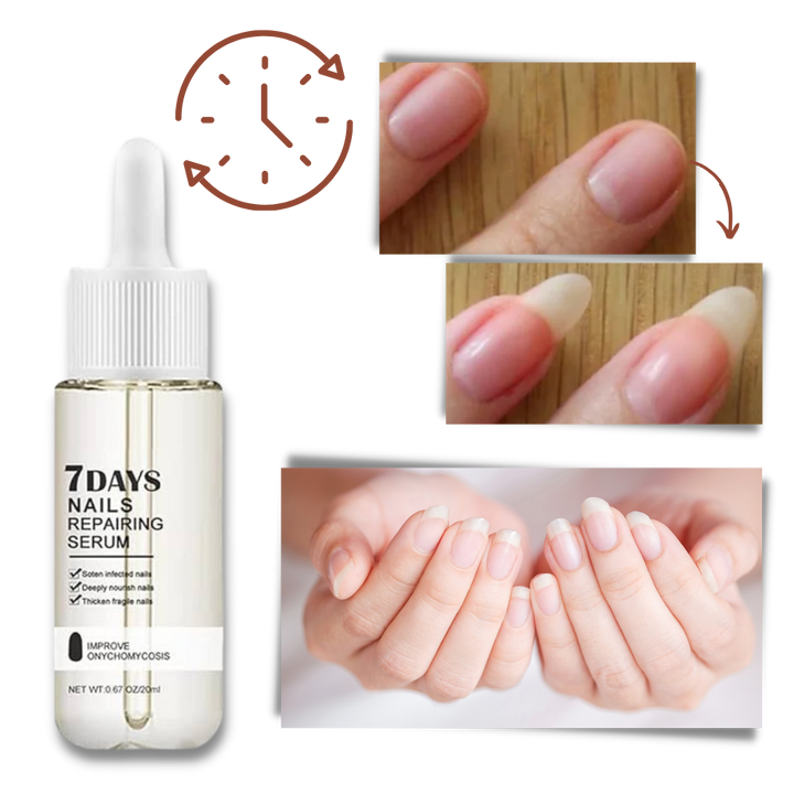 7 Dagar Nagelreparationsessens