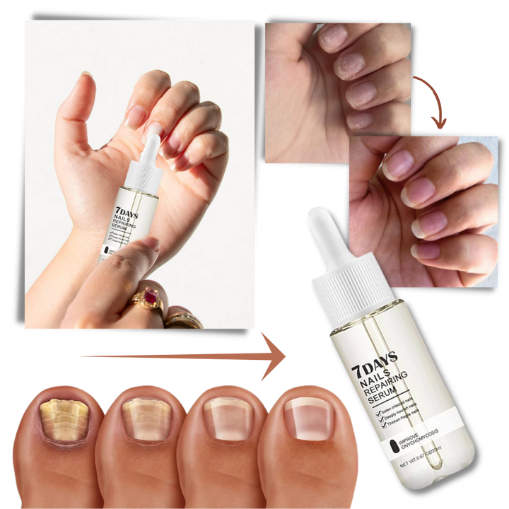 7 Dagar Nagelreparationsessens