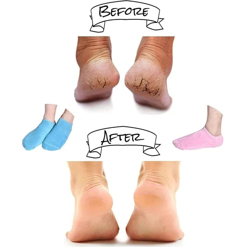 Fuktgivande Strumpor med Spa Gel Foder