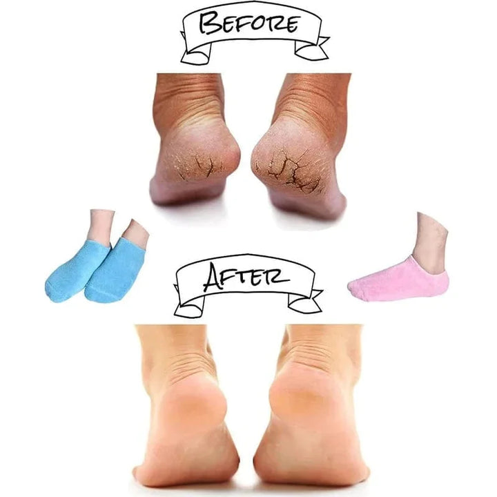 Fuktgivande Strumpor med Spa Gel Foder