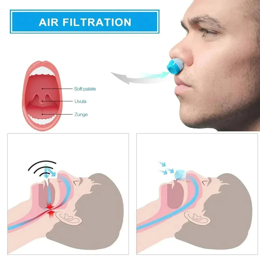 Micro CPAP-sömnapnémaskin för resor &amp; anti-snarkning – CPAP-alternativ