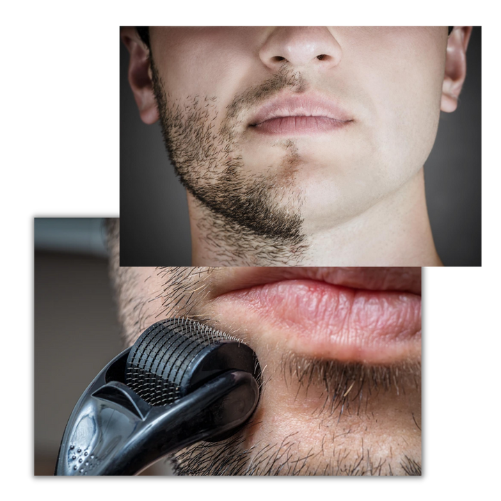 Dermal Roller För Hår Och Skäggtillväxt