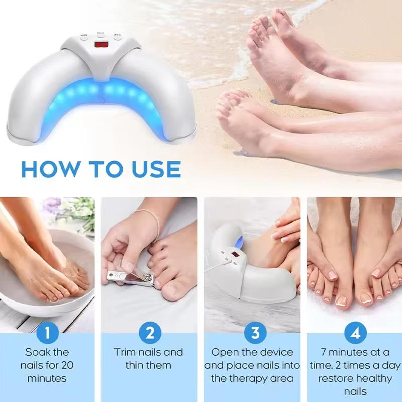 Nagelsvamp Laser