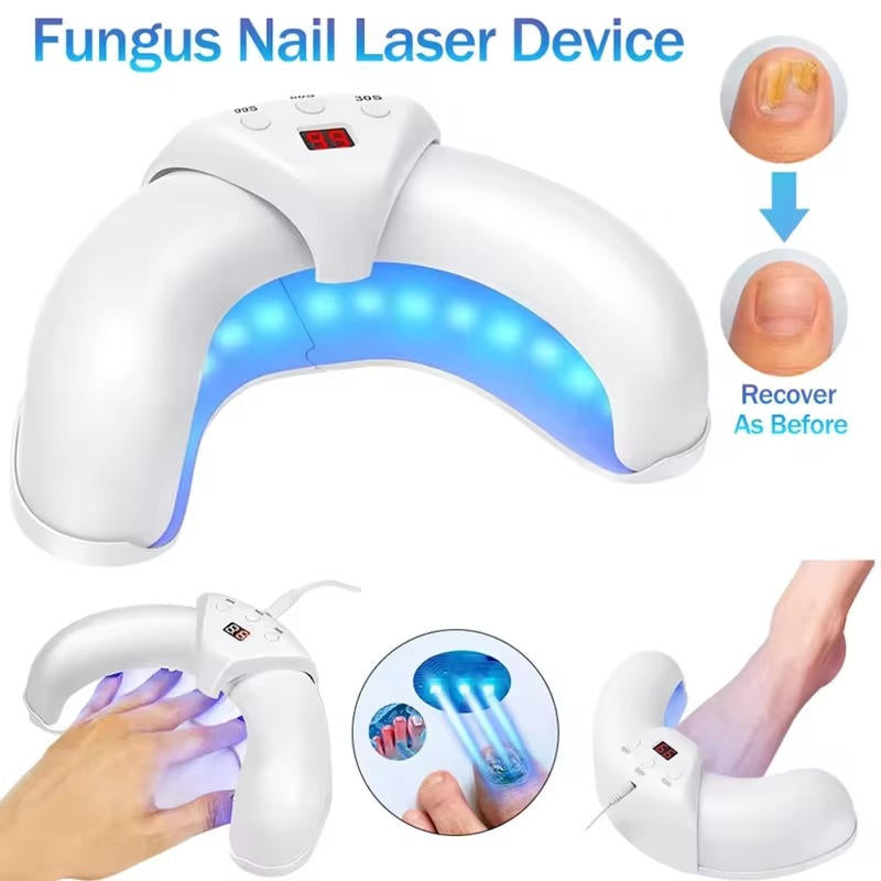 Nagelsvamp Laser