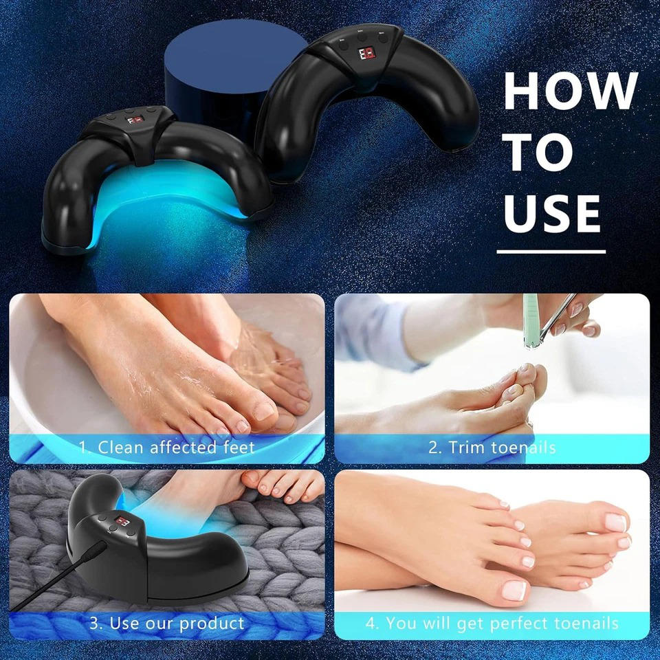 Nagelsvamp Laser